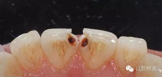 3.webp.jpg 3.webp.jpg