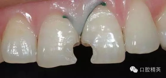 4.webp.jpg 4.webp.jpg