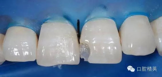 11.webp.jpg 11.webp.jpg