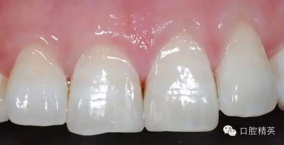 17.webp.jpg 17.webp.jpg