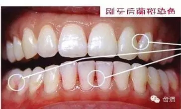 6.webp.jpg 6.webp.jpg