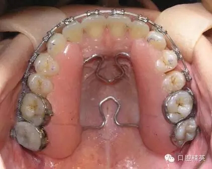 5.webp.jpg 5.webp.jpg