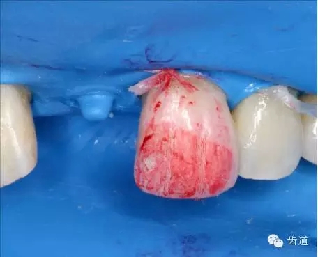 31.webp.jpg 31.webp.jpg