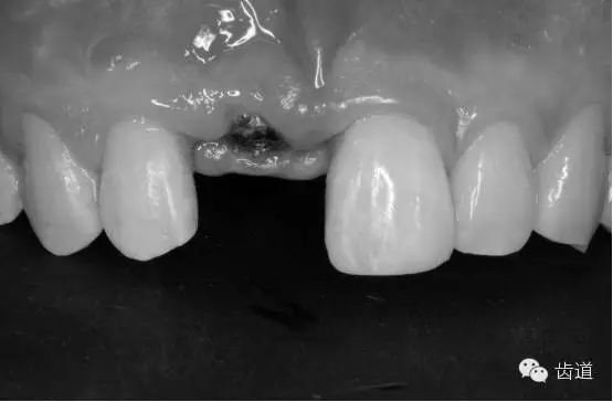 38.webp.jpg 38.webp.jpg