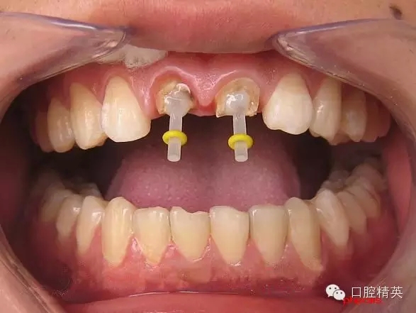 3.webp.jpg 3.webp.jpg