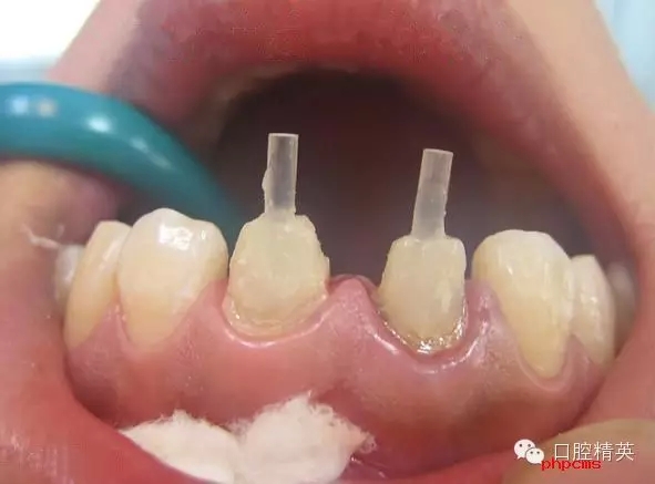 4.webp.jpg 4.webp.jpg