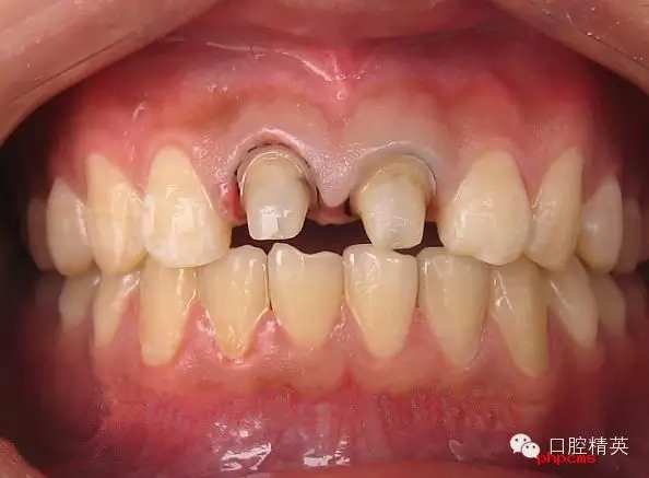 5.webp.jpg 5.webp.jpg