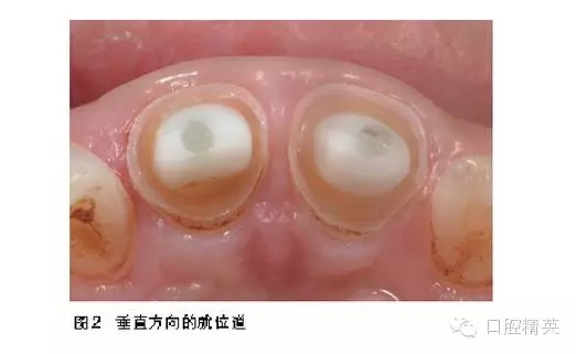 20.webp.jpg 20.webp.jpg