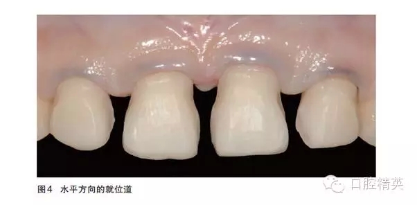 22.webp.jpg 22.webp.jpg