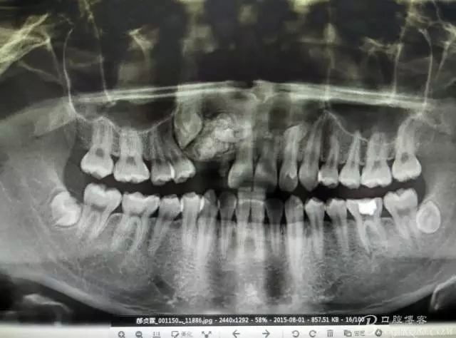 2.webp.jpg 2.webp.jpg