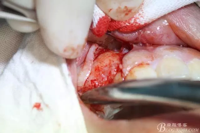 5.webp.jpg 5.webp.jpg