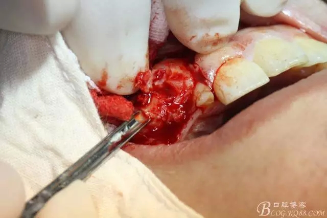 6.webp.jpg 6.webp.jpg