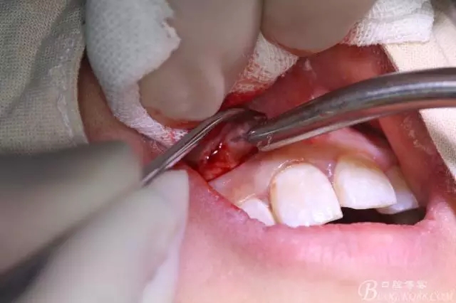 5.webp.jpg 5.webp.jpg