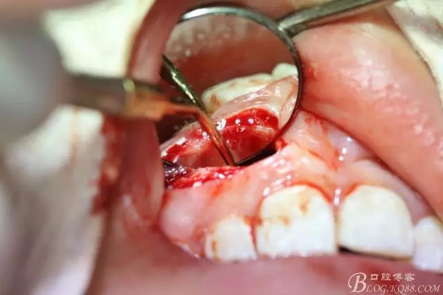 12.webp.jpg 12.webp.jpg