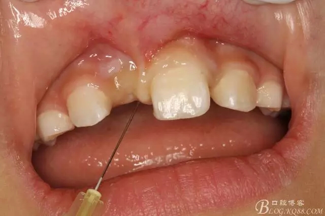 5.webp.jpg 5.webp.jpg