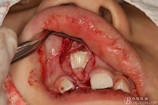 11.webp.jpg 11.webp.jpg