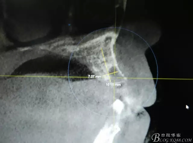 3.webp.jpg 3.webp.jpg