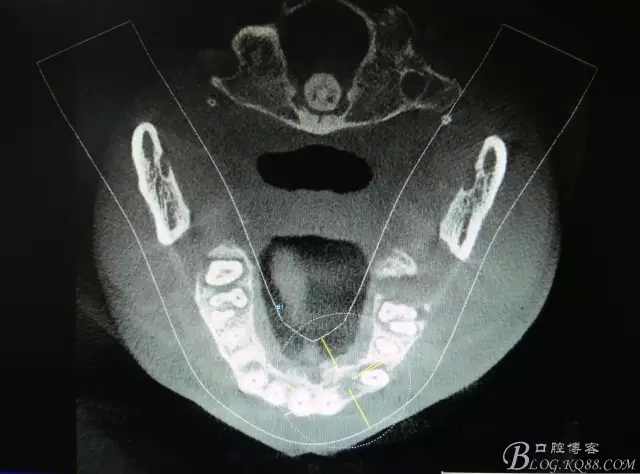 4.webp.jpg 4.webp.jpg