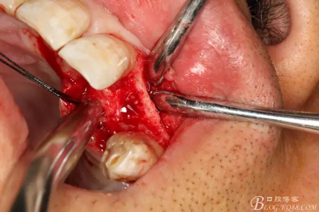 8.webp.jpg 8.webp.jpg