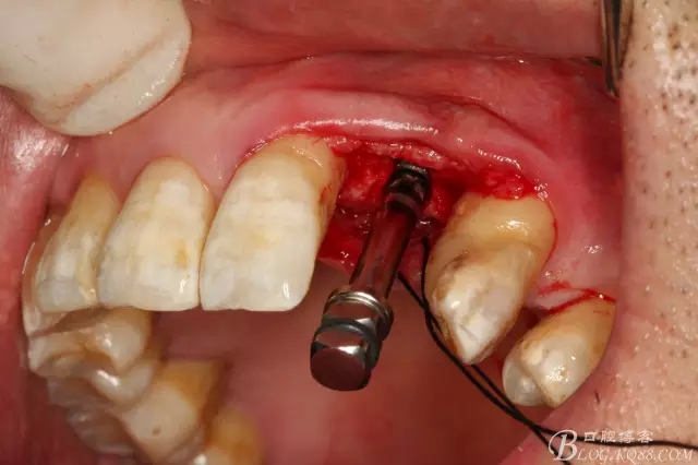 9.webp.jpg 9.webp.jpg