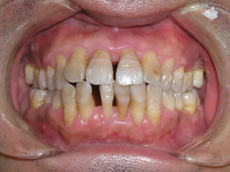 圖片4.png 圖片4.png