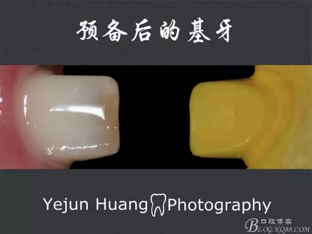 11.webp.jpg 11.webp.jpg