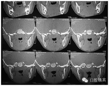 3.1.webp.jpg 3.1.webp.jpg