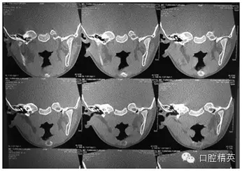 32.webp.jpg 32.webp.jpg