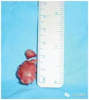 34.webp.jpg 34.webp.jpg