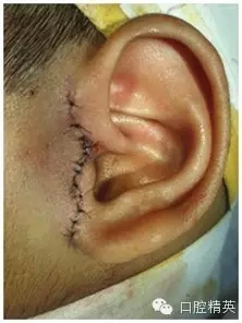 35.webp.jpg 35.webp.jpg