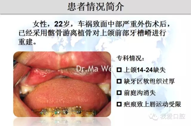 3.webp.jpg 3.webp.jpg