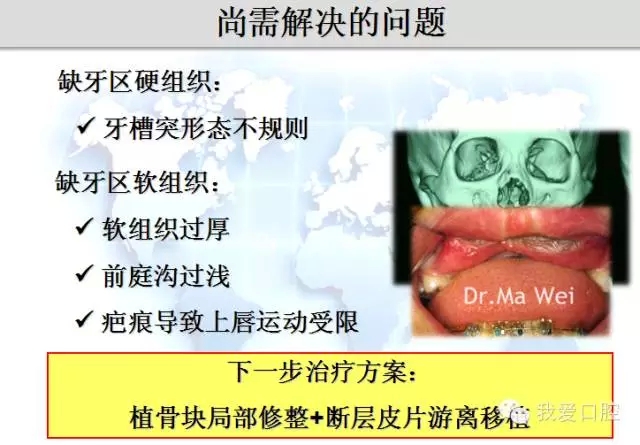 5.webp.jpg 5.webp.jpg