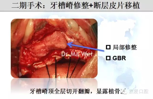 6.webp.jpg 6.webp.jpg