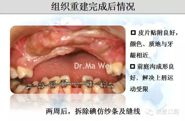 12.webp.jpg 12.webp.jpg