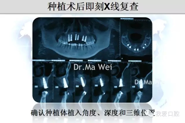 25.webp.jpg 25.webp.jpg