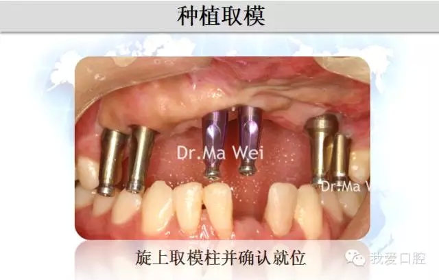 29.webp.jpg 29.webp.jpg