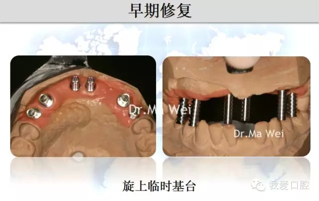 30.webp.jpg 30.webp.jpg