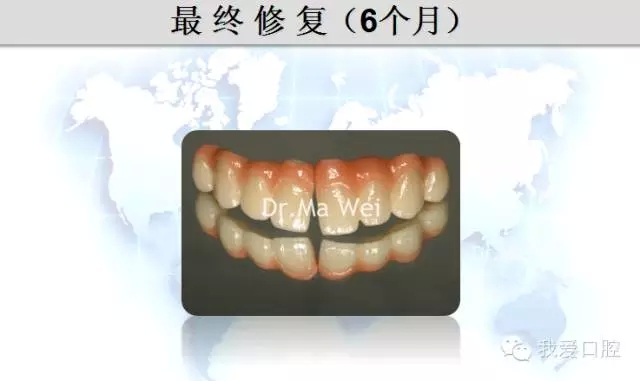 33.webp.jpg 33.webp.jpg