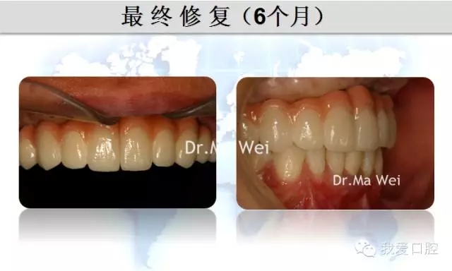 34.webp.jpg 34.webp.jpg