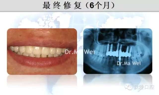 35.webp.jpg 35.webp.jpg