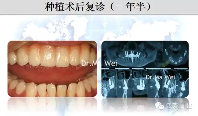 36.webp.jpg 36.webp.jpg