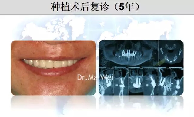 38.webp.jpg 38.webp.jpg