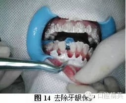 640.webp (7).jpg 640.webp (7).jpg