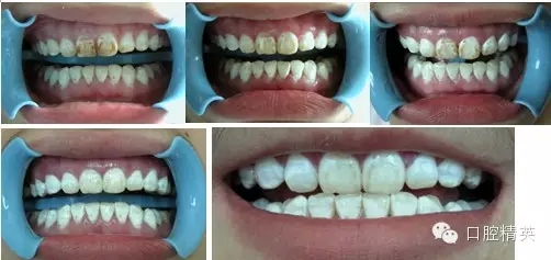 640.webp (9).jpg 640.webp (9).jpg