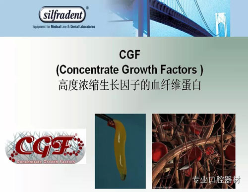 知道PRP?知道PRF?知道CGF? 知道PRP?知道PRF?知道CGF?