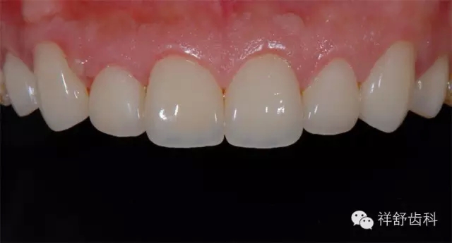 17.webp.jpg 17.webp.jpg