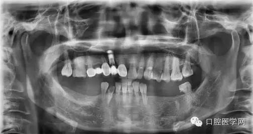 1.webp.jpg 1.webp.jpg