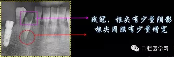 2.webp.jpg 2.webp.jpg