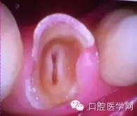 4.webp.jpg 4.webp.jpg