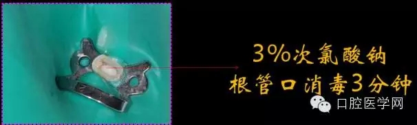 6.webp.jpg 6.webp.jpg